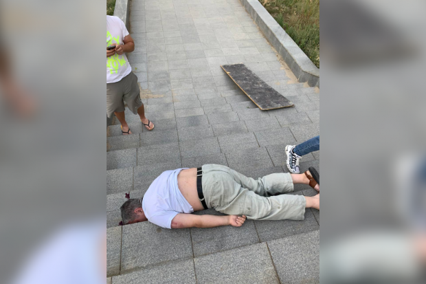 В больнице умер мужчина, на которого упала доска с недостроя в Волгограде